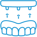 dental implant