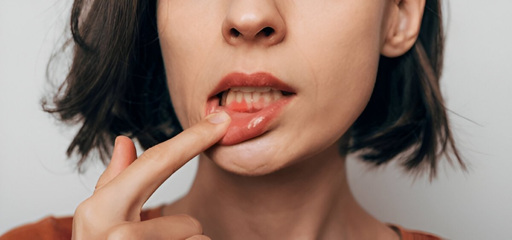 periodontal disease near you