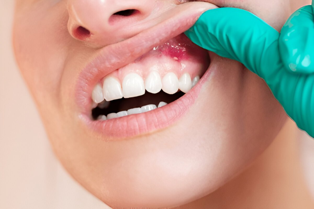 signs and symptoms of gum disease