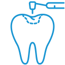 tooth filling