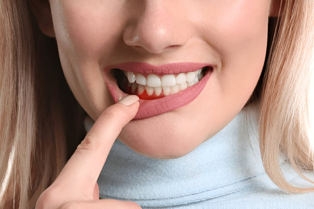 what is periodontal gum disease