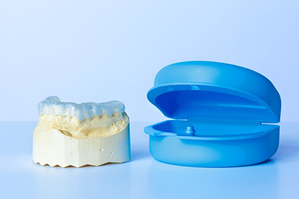 tmd bruxism night guards in sw edmonton