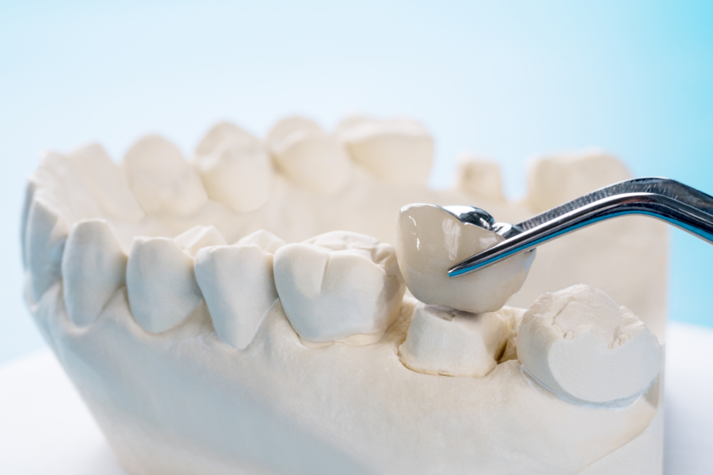 what are the benefits of a dental crown