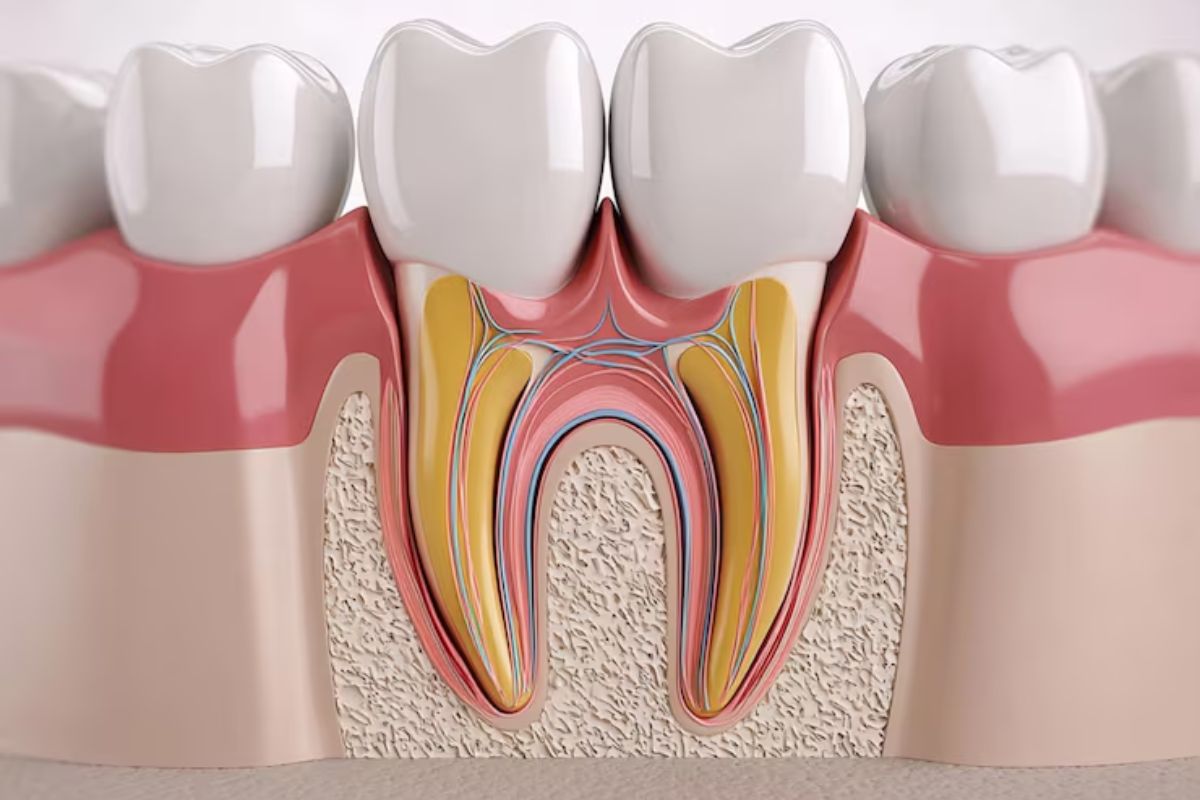 root canal treatment showing infected tooth pulp and internal root canal anatomy