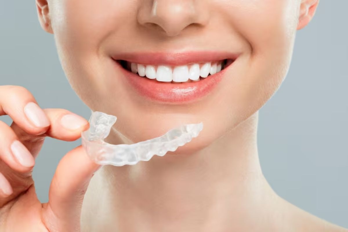 clear aligner for teeth straightening